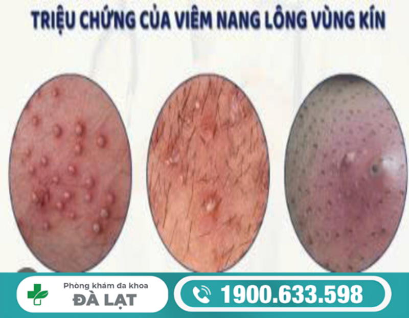 Hình ảnh minh họa